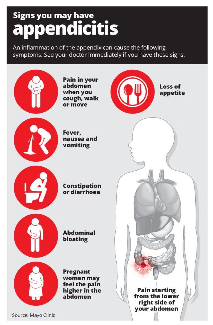 Symptoms And Treatment Of Appendicitis