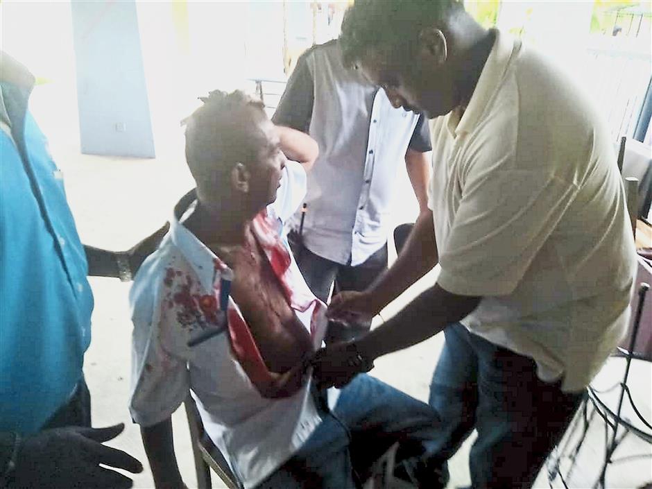 One of the injured PKR members who sustained head injury in a fight at Cinta Sayang Resort during the PKR Merbok Division party election yesterday.He was one of the four men detained by police.(Pictures courtesy by Guang Ming Sungai Petani)(Captioned by G.C.TAN/The Star-22nd SEPT. 2018)